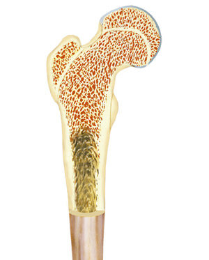 Bone marrow is the cellular material found in the center of bones, and is critical for the function of the immune system.  