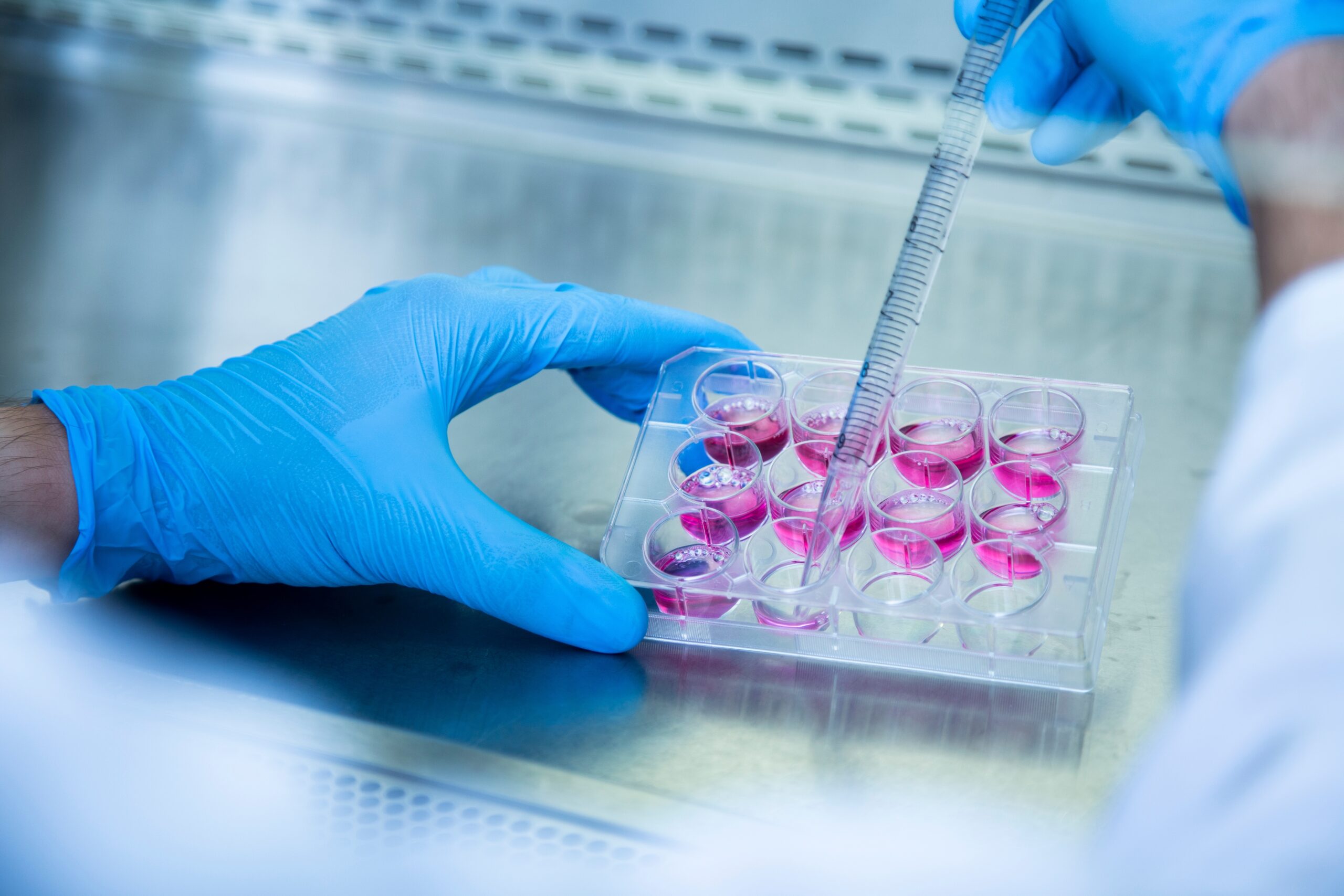 Mini brains grown in a dish shed light on Huntingtonās disease and how we might treat it